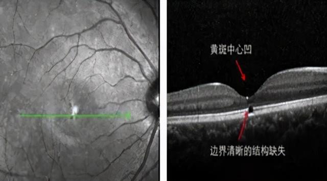 激光防护(激光个人防护措施) 第3张